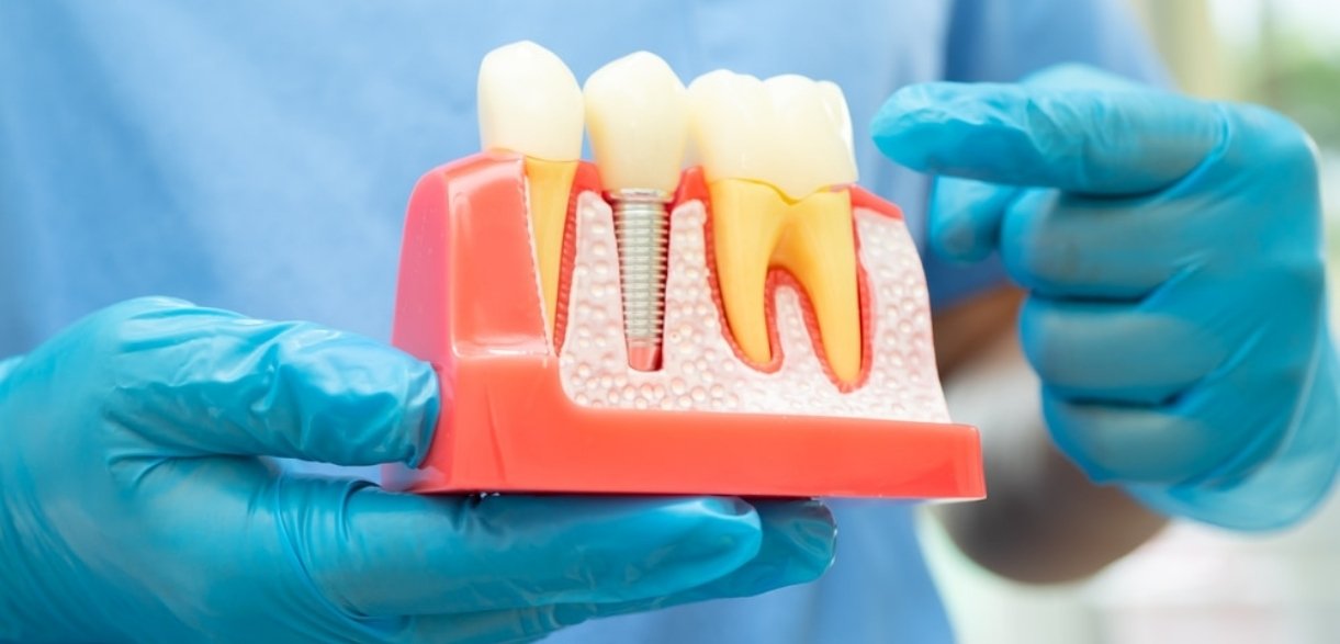 Dentist NYC Secrets: What Makes the Best Dentist NYC So Special?
